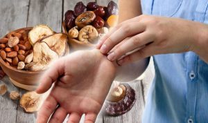 Eczema Treatment – Why Your Diet Plan Matters